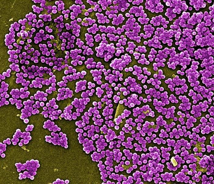 MRSA bacteria seen through a microscope
